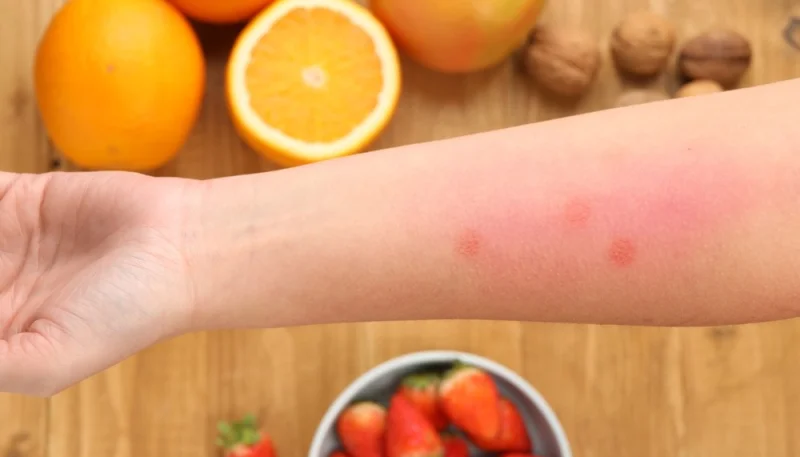 Comment adapter les recettes pour les allergies alimentaires